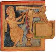 HEMROIDS - An 11th century picture of a hemroid operation