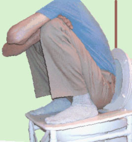 A squat toilet converter for a standard type toilet